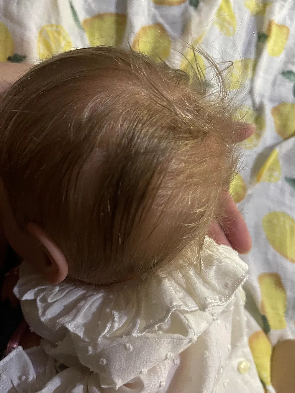 Otillie Love C Brace - Image 12